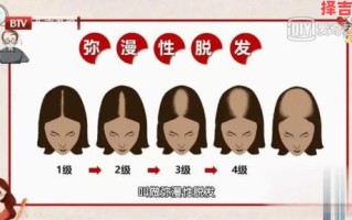 梦见掉头发预示什么？周公解梦解析掉发梦境含义