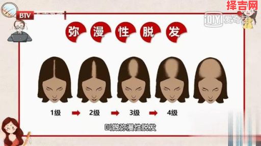 梦见掉头发预示什么？周公解梦解析掉发梦境含义-第1张图片