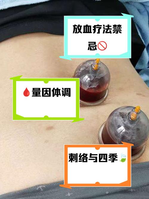 2026年4月点刺放血适宜日子 2026年3月点刺放血吉日查询-第1张图片 2026年4月点刺放血适宜日子 2026年3月点刺放血吉日查询-第1张图片